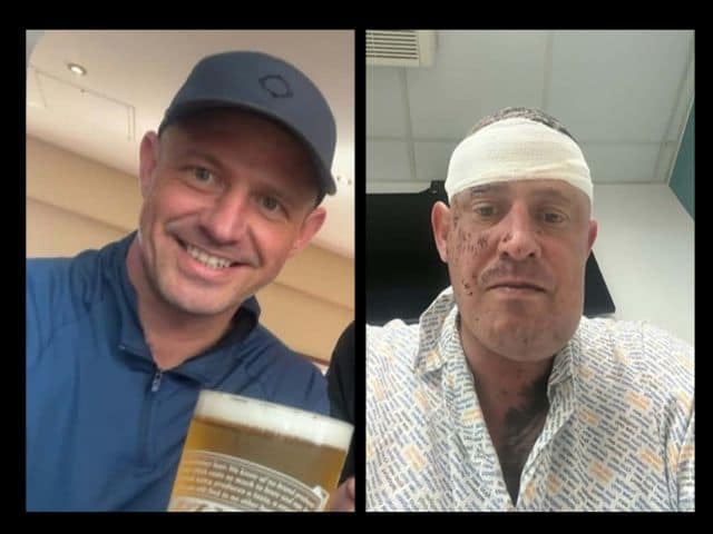 Westbrook dad faces further surgery after attacker knocks him unconscious and breaks jaw in two places